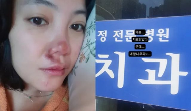 Oyuncu Go Eun Ah, yüzünden ciddi bir şekilde yaralandı ve tedavi görüyor